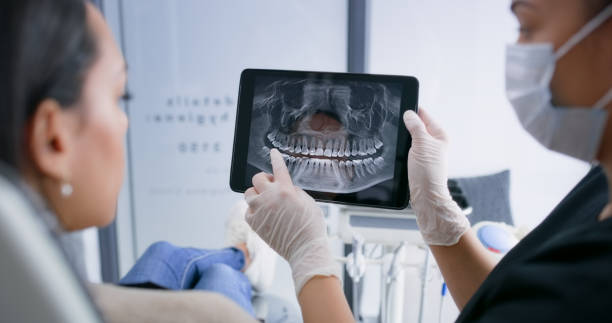 Licensed Tooth Extraction service in Los Gatos, CA - Smile Center Dentistry